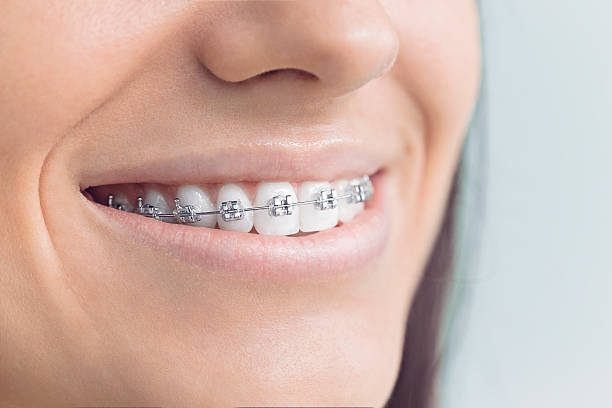 Best Dental Fillings (Composite and Amalgam)  in Kean University, NJ